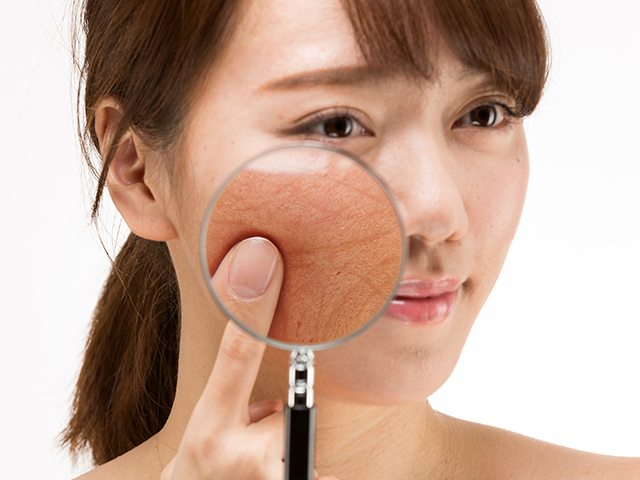 練馬区のシミ治療は皮膚科専門医が保険診療を中心に診察